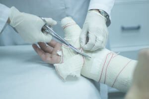 doctor cutting off a cast on arm