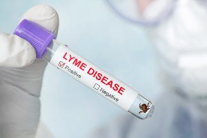 lyme disease vial for testing