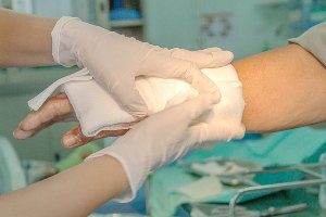 putting bandages on burn injury on arm